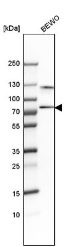 SNX18 Antibody, Novus Biologicals 0.1mL; Unlabeled:Antibodies, Polyclonal
